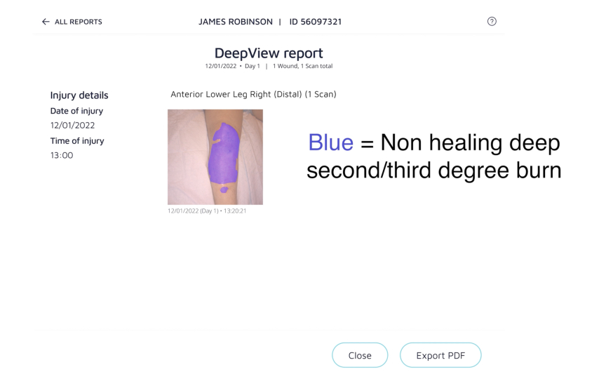 Adapting transparency to risk levels